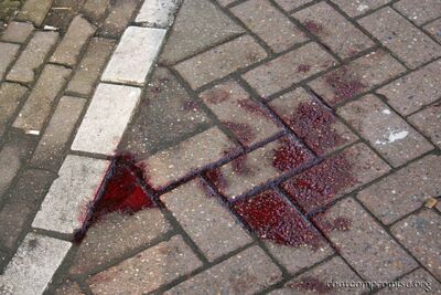 Yup, it's blood.